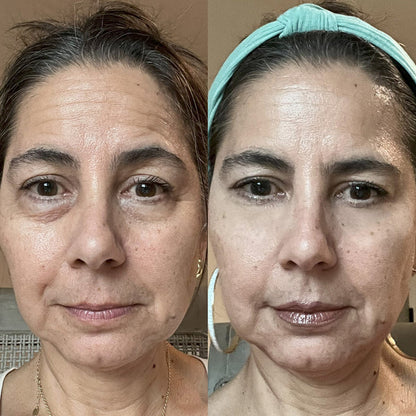 DermaEyes™