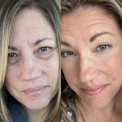 DermaEyes™