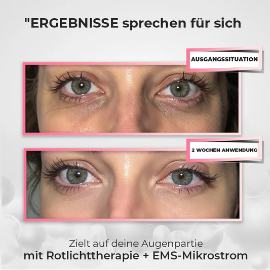 DermaEyes™
